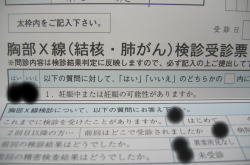 検診